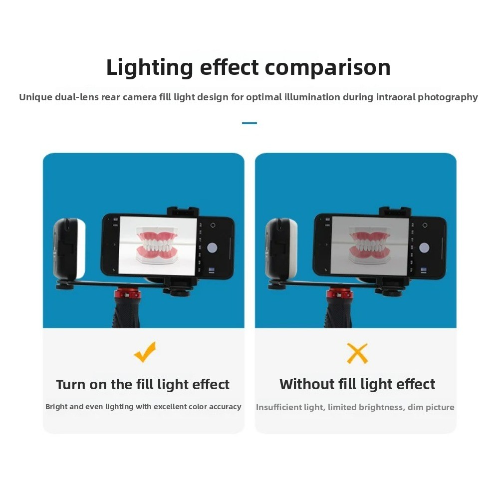 치과 사진 촬영 조명, 스마트폰용 블루투스 LED 플래 - Photography Basics 리뷰 및 가격